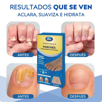Parche 16 Und Para Hongos De Uñas